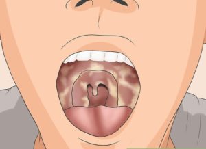 Зелёная неприятная на вкус слизь стекает по задней стенке горла