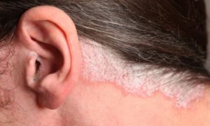 Рана за ухом