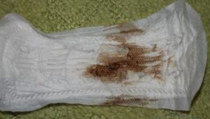 Мазня после месячных 5 дней