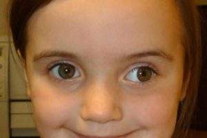 Чувство что глаза сходятся в кучу