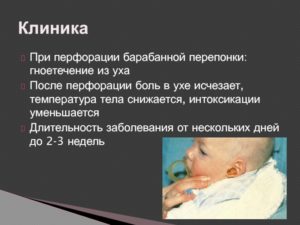 Прерывистый выдох у ребенка