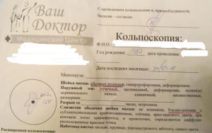 Расшифровка результата кольпоскопии онлайн