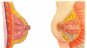 Комки в груди при грудном вскармливании