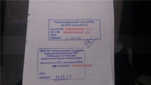 Может ли быть можно отрицательный результат ифи антител к вич