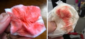 Мазня после месячных 5 дней