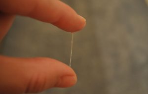 ЯБ при овуляции