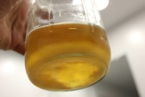 Песок в моче кирпичного цвета в осадке