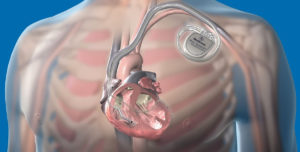 Дергается седце