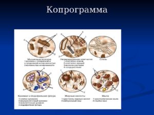 Копрограмма