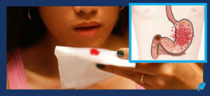 Ребёнок срыгивает с кровью