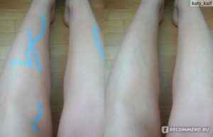 Просвечивают вены на ногах