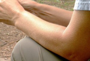 У левого плеча как будто бегают мурашки