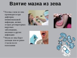 Когда самое раннее после заражения показывает мазок на коклюш