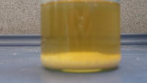 Песок в моче кирпичного цвета в осадке