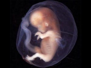 Околоплодные воды