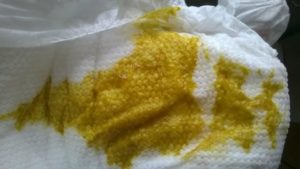 Кислый запах кала у ребенка