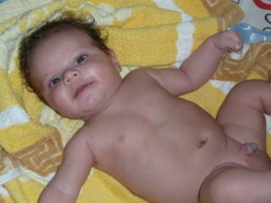 Рождение мальчика с открытой головкой на писюне