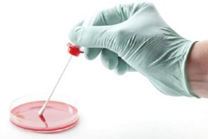 Когда самое раннее после заражения показывает мазок на коклюш