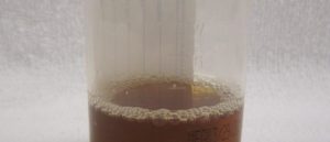 Песок в моче кирпичного цвета в осадке