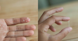 Белые выделения после занятий спортом