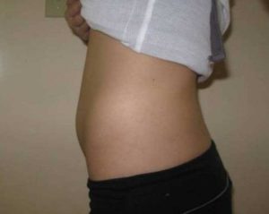 Болит живот на 8 неделе беременности