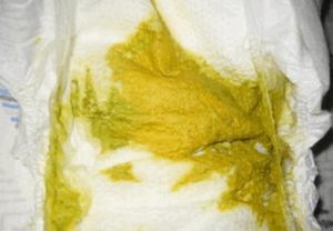 Кислый запах кала у ребенка