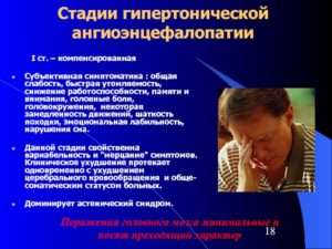 Головокружения и шаткость на улице