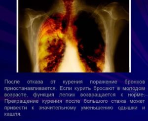 Бросил курить темная мокрота