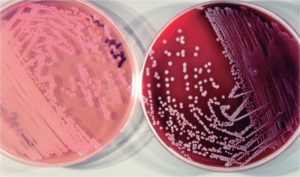 Бактерия enterobacter aerogenes