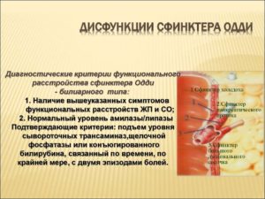 Дисфункция сфинктера Одди