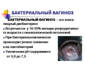 Бактериальный вагиноз и беременность
