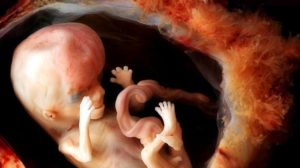 Замершая беременность 15-16 недель