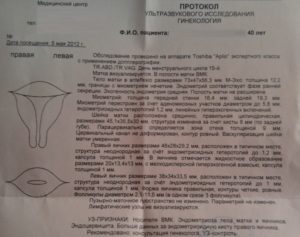 Кисты яичников, какие анализы на гормоны нужно сдать