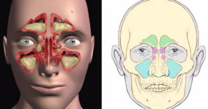 Болит кость под глазом