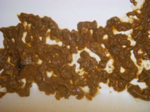 Диарея от рыбьего жира