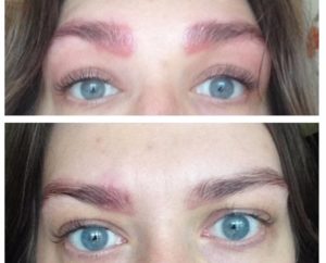 Ожог от краски для бровей