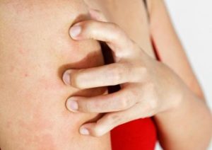 Сильный зуд по всему телу