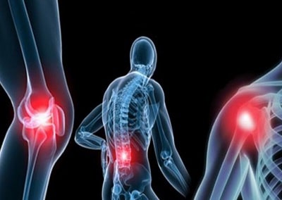 Деформирующий остеоартроз: диагностика и лечение деформирующий остеоартроз код по мкб 10
