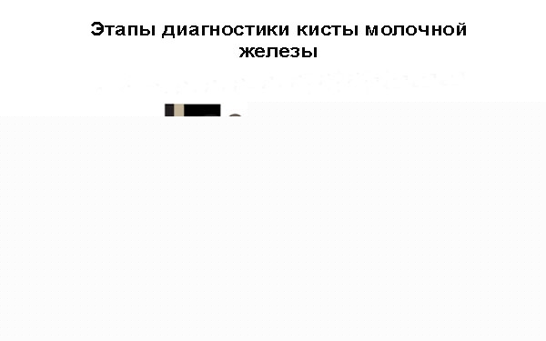 диагностика кисты молочной железы