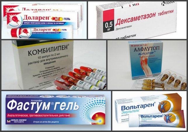 Боли в суставах: как избавиться от сильных болей в суставах?