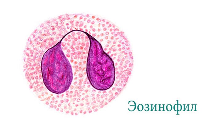 Эозинофилы. Норма у женщин по возрасту, таблица, расшифровка в анализе, лечение