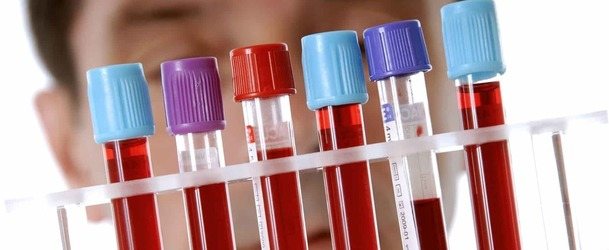 Эозинофилы повышены в крови у взрослого, что это значит