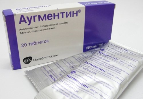Гиперемирована слизистая. Что это значит умеренно, очагово, диффузно у взрослого, ребенка, лечение