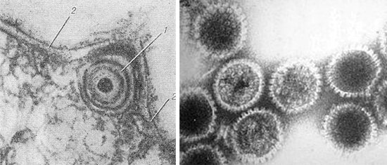 Herpes virus выход из клетки
