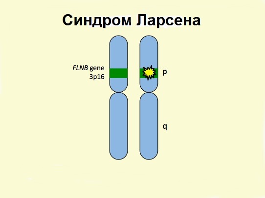 Пораженные хромосомы
