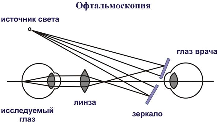 Макулодистрофия сетчатки глаза лечение