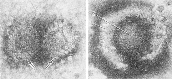 незрелые вирионы Herpes simplex virus 1