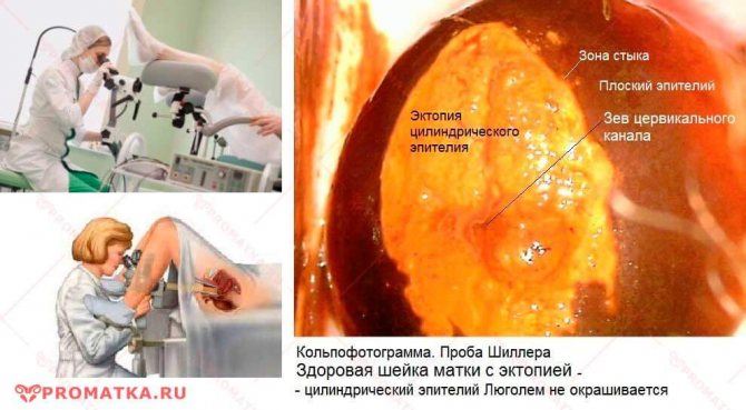 Проба Шиллера