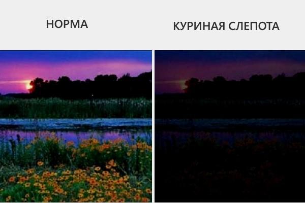 Проявление куриной слепоты