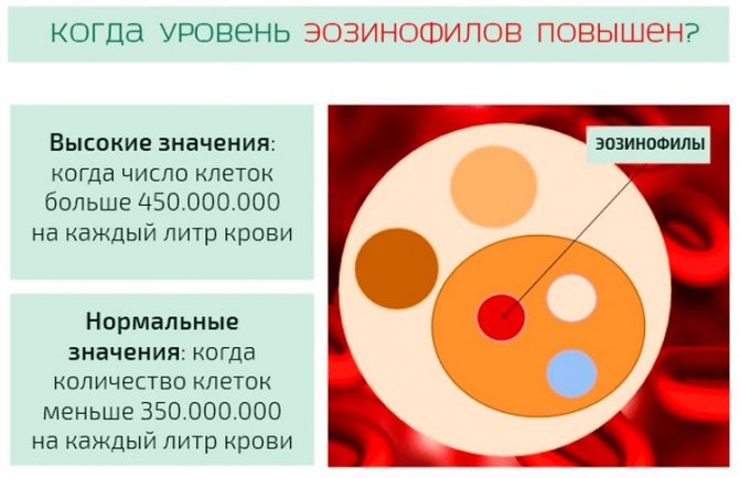 Различаются следующие степени эозинофилии